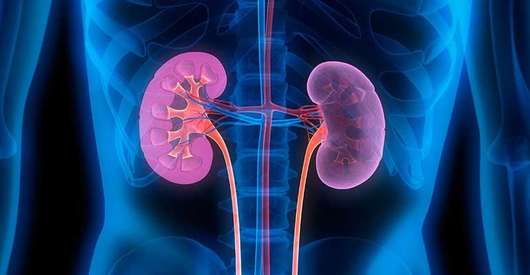 Kidney Diseases